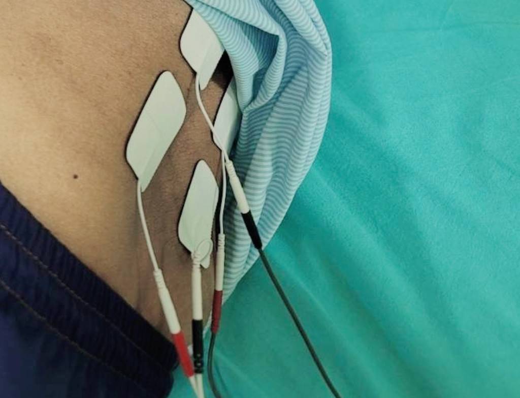 กายภาพระบบประสาท